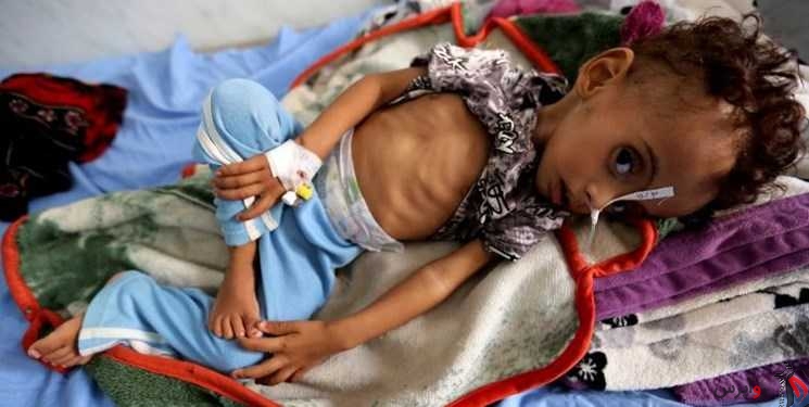 مقام سازمان‌ملل: 400 هزار کودک یمنی به دلیل سوء تغذیه با مرگ فاصله‌ای ندارند