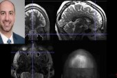 سینوزیت مزمن فعالیت مغز را تغییر می‌دهد