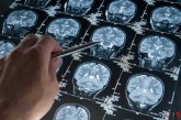 پیشگیری و درمان اعتیاد به کمک نقشه برداری از مغز