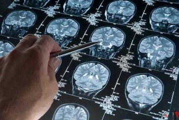 پیشگیری و درمان اعتیاد به کمک نقشه برداری از مغز